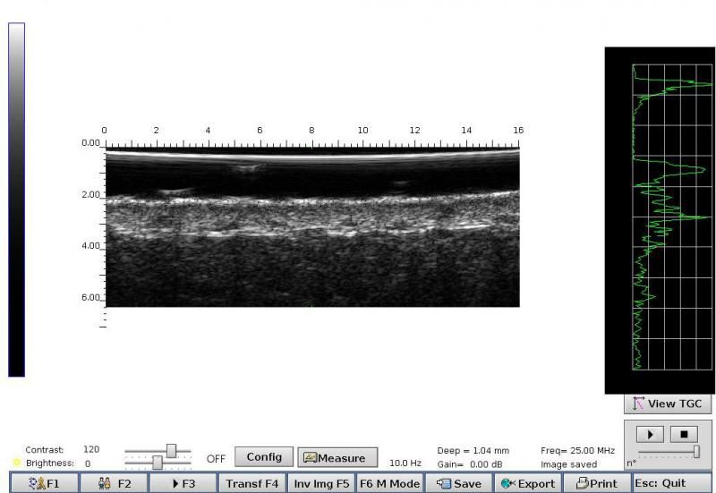 Example of forearm imaging
